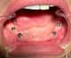 Slider image (10) Smiletec® - Leading Mexicali Dental Clinic